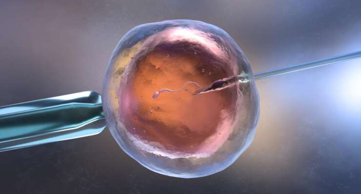 Intracytoplasmic Sperm Injection (ICSI)