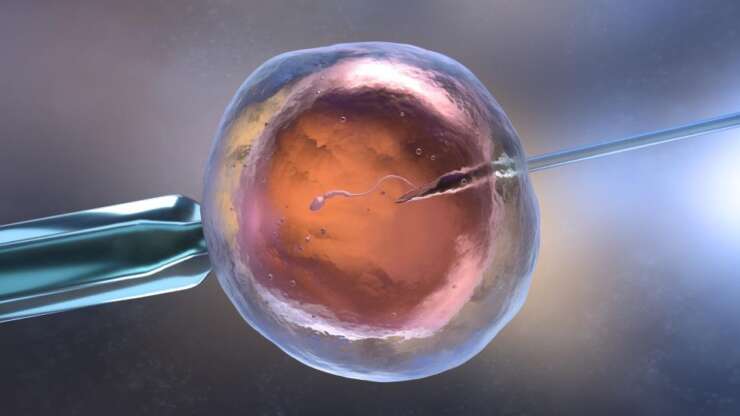 Understanding when to consider IVF